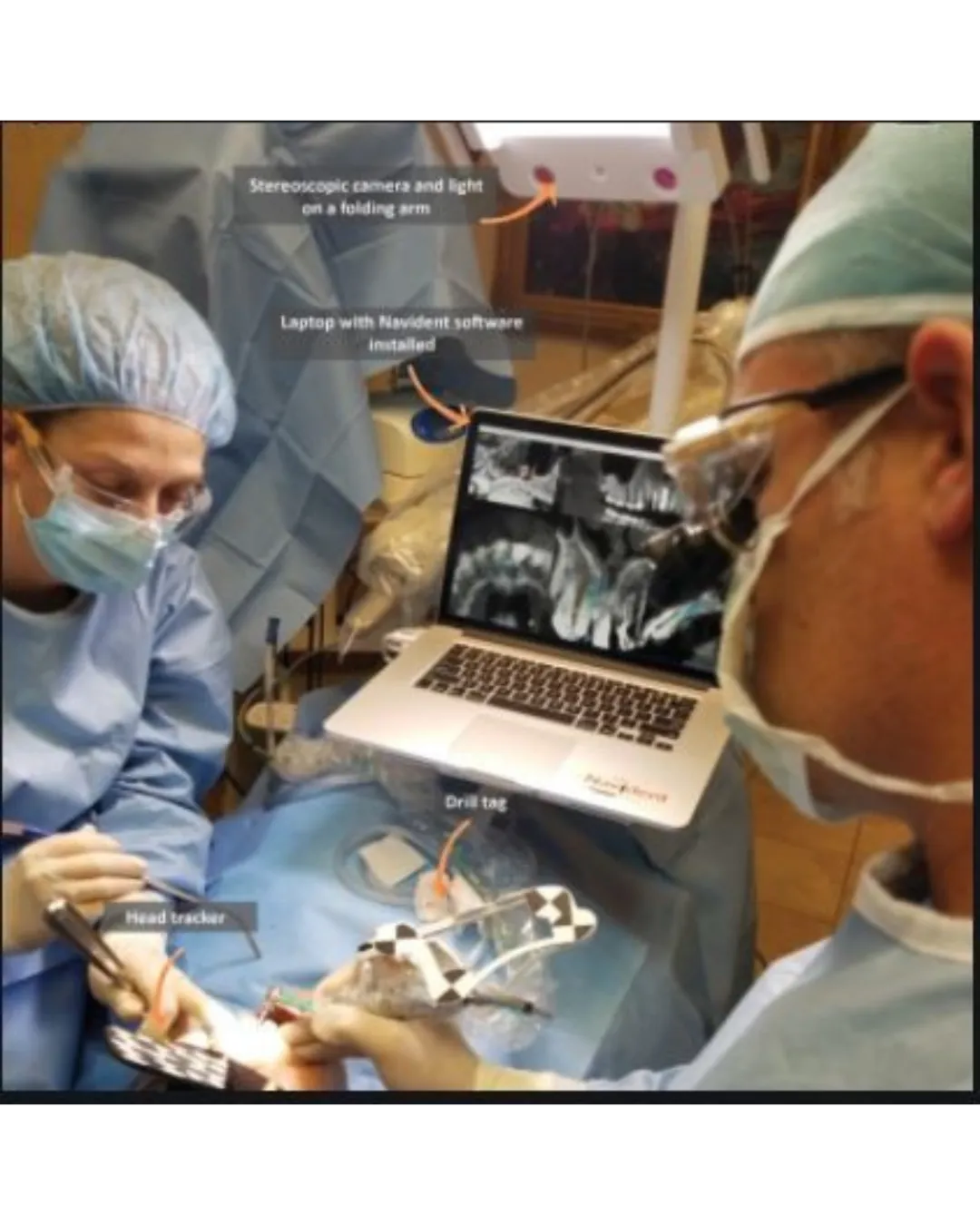 Navident 3.0 in clinical use